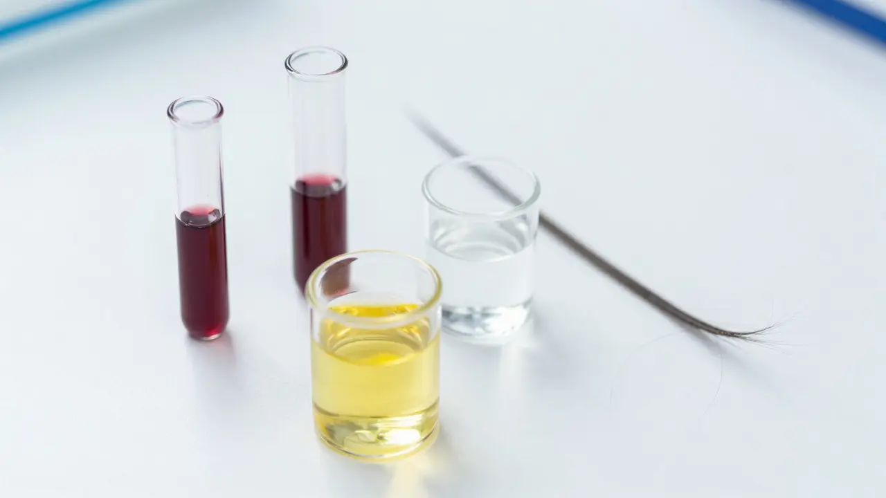 Laboratorní vzorky moči, krve, slin a vlasů pro testování